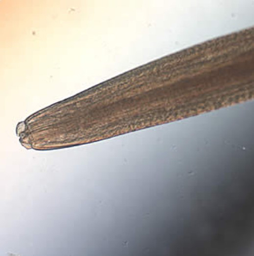 Figure 1. The piercing stylet of Pseudoterranova decipiens showing prominent lips. Photograph by Centers for Disease Control and Prevention, https://www.cdc.gov/dpdx/anisakiasis/index.html. 