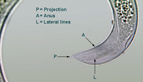 The tail (T) of Helicotylenchus pseudorobustus