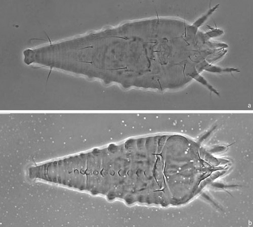 Micrograph of female Oxycenus maxwelli (Keifer) showing a ventral view (a) and a dorsal view (b).