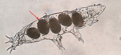 Image of eggs inside a tardigrade exoskeleton.