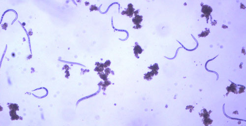 Second-stage juveniles (J2) of the grass root-knot nematode, Meloidogyne graminis Whitehead, extracted from soil, along with a few bacterial-feeding nematodes. J2 are worm-shaped and mobile, this is the infective stage. Photograph by William T. Crow, University of Florida.