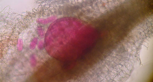Adult female grass root-knot nematode, Meloidogyne graminis Whitehead, inside of a bermudagrass root. The female is rounded and is starting to lay eggs inside of the root.The nematode has been stained red for observation. Photograph by Nick Sikora, University of Florida.