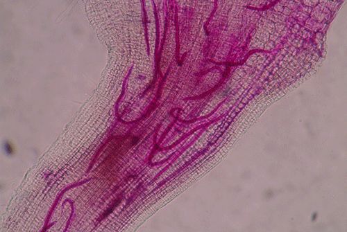 a mellbimbó patológiájának florid papillomatosisai körvonalazódnak