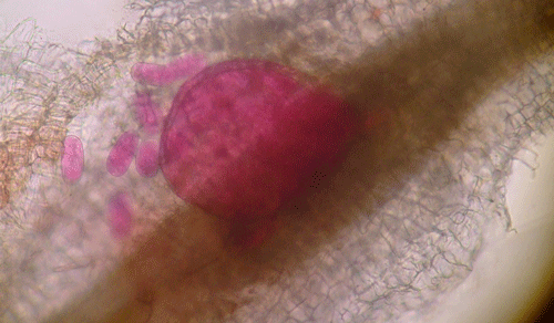 Adult female root-knot nematode inside of a root