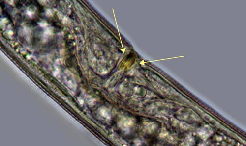 The vagina of most Belonolaimus longicaudatus females is surrounded by sclerotized pieces. 