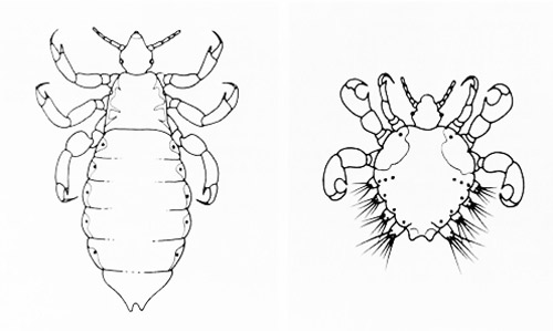 Body Louse And Head Louse Pediculus Spp