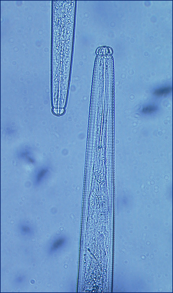 microscope image of a nematode