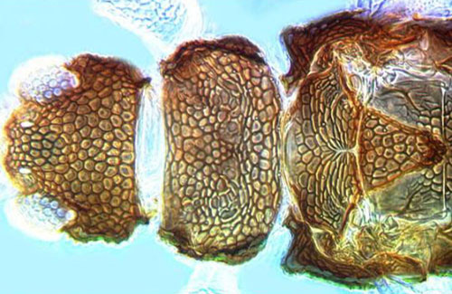 Head and thorax of an adult greenhouse thrips, Heliothrips haemorrhoidalis (Bouché). 