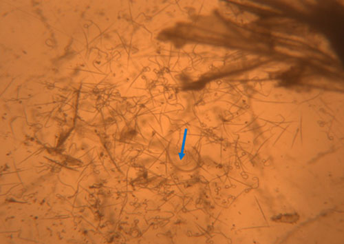 Figure 3. Contents from ruptured Anguina pacificae gall including juveniles and adults. The blue arrow points to an adult all the smaller nematodes present are juveniles. Photograph by C. L. Kammerer, University of Florida.  