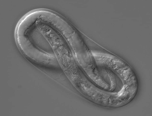 Figure 3. Root-knot nematode first-stage juvenile (J1) in the eggshell. Note that this image is of Meloidogyne incognita. Photograph by Hung Xuan Bui.