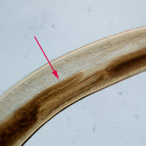 Figure 2. The intestinal cecum (the pouch that connects small and large intestines) of Pseudoterranova decipiens. Photograph by Centers for Disease Control and Prevention, https://www.cdc.gov/dpdx/anisakiasis/index.html.