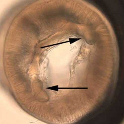 Figure 3. The prominent butterfly-shaped set of chords noticeable in cross-section of Pseudoterranova decipiens. Photograph by Centers for Disease Control and Prevention, https://www.cdc.gov/dpdx/anisakiasis/index.html.