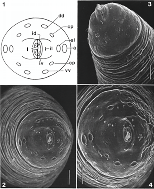 Figure 1. The stylet and papillae of Trichinella spiralis, showing multiple pairs of labial and cephalic papillae and a prominent and distinctive piercing-type stylet. Photograph from Lichtenfels et al. 1983. 