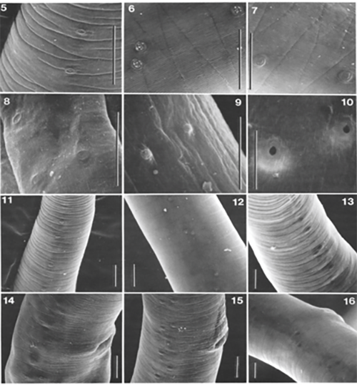 Figure 2. The characteristic ridges and creases seen in the cuticle of Trichinella spiralis, under electron microscopy. Photograph from Lichtenfels et al. 1983. 