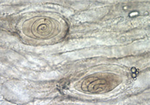 Figure 3. Encapsulated larval cells in nurse cell-parasite cell complexes, as seen in the biopsy of bear muscle tissue.  (Photograph by Centers for Disease Control and Prevention, https://www.cdc.gov/parasites/trichinellosis/diagnosis.html 