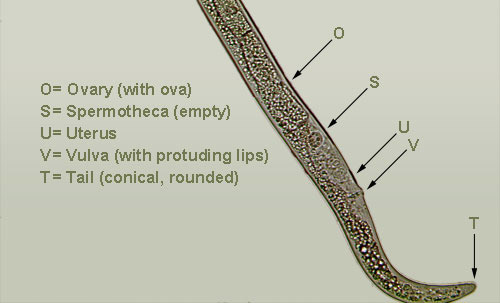 The tail region of a female amaryllis lesion nematode with conical, rounded tail, protruding vulval lips, and empty spermotheca