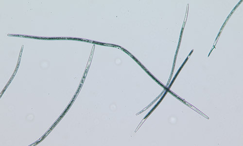 Sting nematode Belonolaimus longicaudatus.