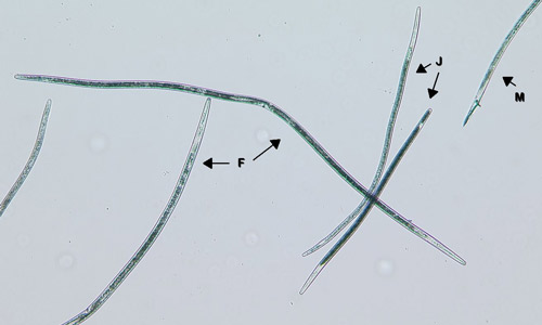 Juvenile Belonolaimus longicaudatus differ from adult females (F) and (Males) only by size and absence of developed sex organs. 