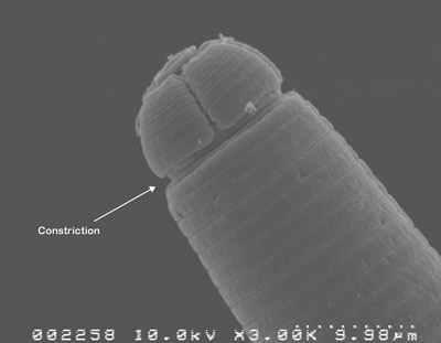 The anterior of both sexes of Belonolaimus longicaudatus is set off by a deep constriction.