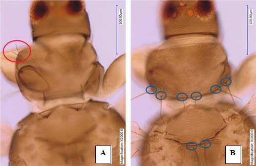 Image: Megalurothrips_usitatus04.jpg
Figure 4. Head and thorax (Pro, meso and meta thorax) of an adult bean flower thrips, Megalurothrips usitatus Bagnall, showing (A) prothoracic (red circle) and (B) meta-thoracic setae (blue circle). Photograph by Rafia A. Khan, Entomology and Nematology Department, University of Florida.