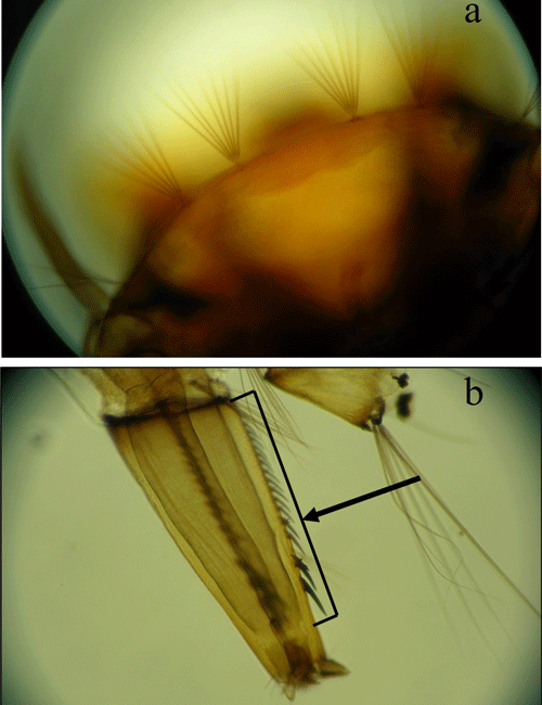 Branched setae along front margin of larval Aedes japonicus