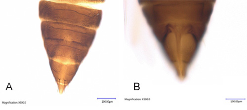 Figure 6. Abdominal tergites of female adult bean thrips, Caliothrips fasciatus Pergande, showing abdominal tergite VII and IX (A) and ovipositor (B). Photograph by Rafia A. Khan, Entomology and Nematology Department, University of Florida
