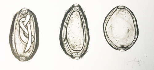 Three egg stages of a Huffmanela nematode. The far right egg is recently laid, and the eggs develop from right to left. The middle egg is unlarvated, but has a fully developed shell. The left egg has a fully larvated nematode ready to emerge. Figure by Fauve Wilson.