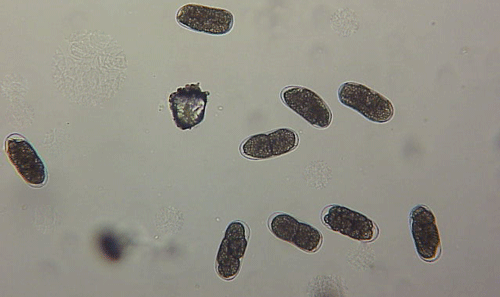 Young eggs of root-knot nematodes