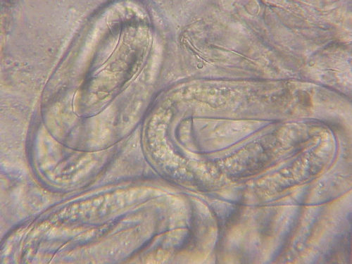 Mature eggs of root-knot nematodes