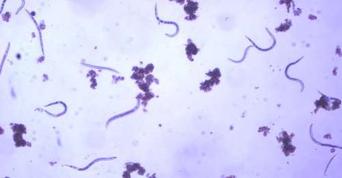 Second-stage juvenile (J2) root-knot nematodes extracted from soil,