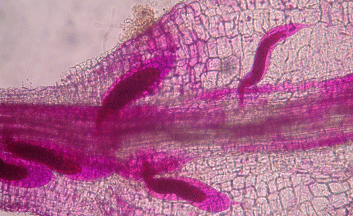 Third-stage juveniles (J3) of root-knot nematode inside of a root