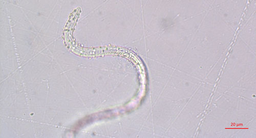 Meloidogyne arenaria nematode with Pasteuria penetrans endospores adhering to its cuticle.