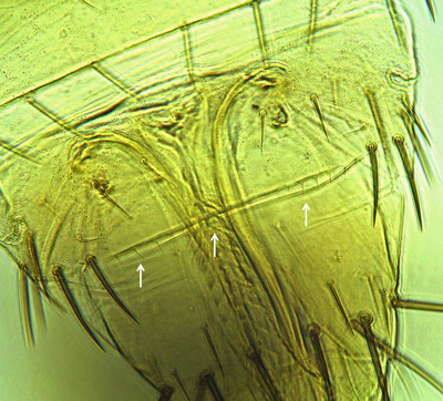 Abdominal segment VII of Frankliniella bispinosa Morgan with incomplete comb (arrowed); complete comb in Frankliniella occidentalis.