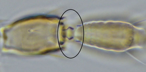Setae arising from antennal segment II of Frankliniella tritici (Fitch) are simple.