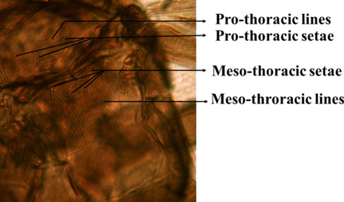 Pro and meso thoracic segments of an adult composite thrips, Microcephalothrips abdominalis Crawford, showing the lines and setae.