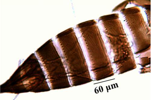 Abdominal tergites of an adult composite thrips, Microcephalothrips abdominalis Crawford. 