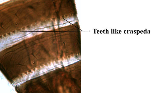 Tergites VI and VII of an adult Microcephalothrips abdominalis Crawford, showing teeth like craspeda on the posterior margin