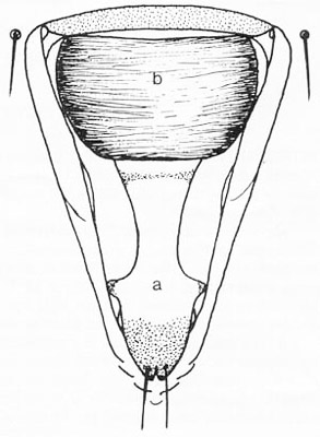 Vasiform oriface [ a - linguala, b - operculum ] of the nymph of the bayberry whitefly, Parabemisia myricae (Kuwana).