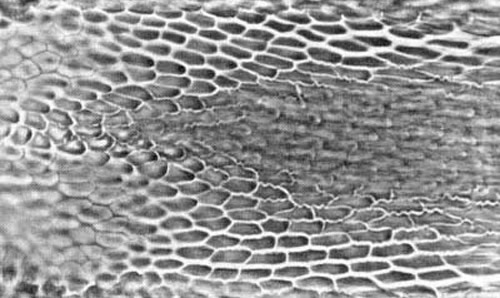 Microreticulation near base of the ovipositor of an adult female guava fruit fly, Bactrocera correcta (Bezzi). 
