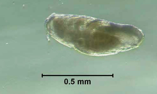 Egg, with embryo present, of the little blue cattle louse, Solenopotes capillatus (Enderlein). 