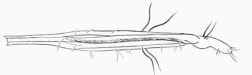 Lateral view of ovipositor. 