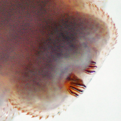 Side view of posterior spiracles of the larva of the human bot fly, Dermatobia hominis (Linnaeus Jr.).