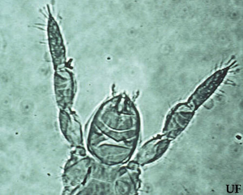 Prothoracic legs, head and thorax of the proturan Eosentomon maryae Tipping, (300x). 