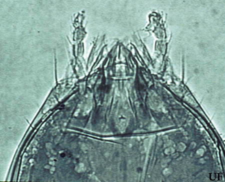 Photomicrograph of the head of Eosentomon megatibiense Tipping, with mouthparts inserted inside of the head capsule (900x). 
