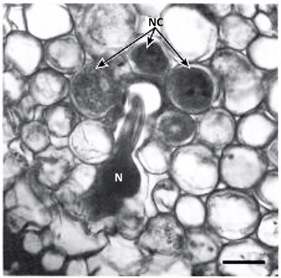 Cross section of Poncirus trifoliate root parasitized by the Poncirus biotype of the citrus nematode, Tylenchulus semipenetrans (Cobb, 1913). Note the nematode (N) head surrounded by the nurse cells (NC). 