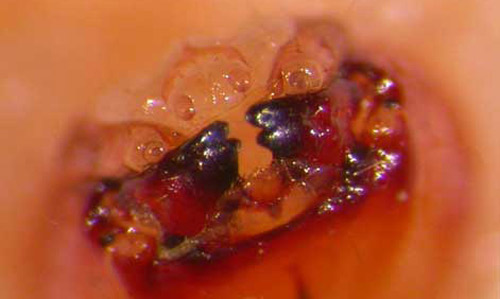 Head capsule and mandibles of the larva of Eurhinus magnificus Gyllenhal, a weevil. 
