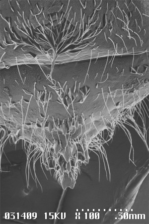 Dorsal view of tip of abdomen of petiole gall psyllid, Pachypsylla venusta (Osten-Sacken), showing abdominal cutting teeth (scanning electron micrograph). 