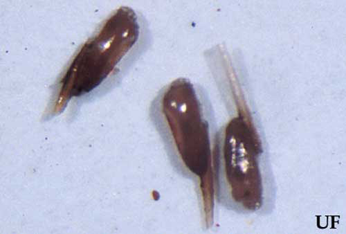 Dark nits (eggs) of head lice, Pediculus humanus capitis De Geer, glued on pieces of hair shafts. 