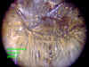 antabrmalescutellum.JPG (54601 bytes)