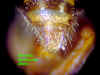 nomdenmalepygidium.JPG (52265 bytes)
